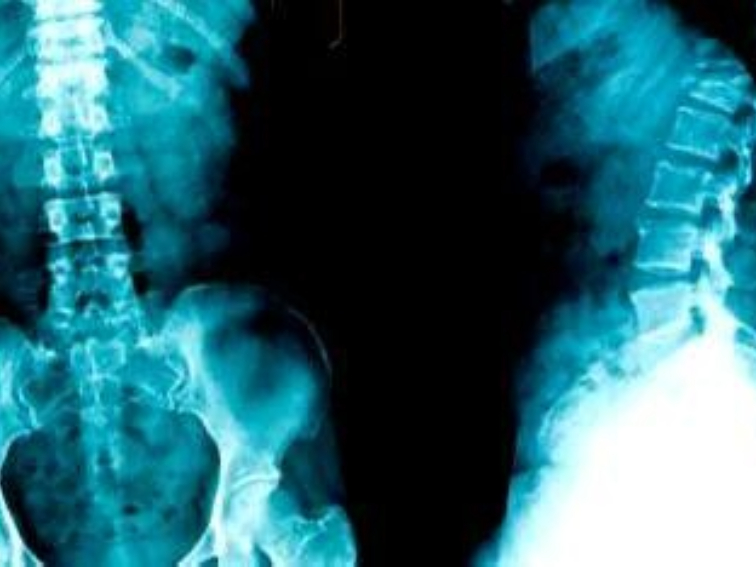 Безплатен семинар „Достъпно за костното здраве“ с утвърдени специалисти във Варна