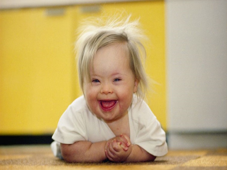 Безплатни консултации за деца със синдром на Даун и техните родители в Плевен