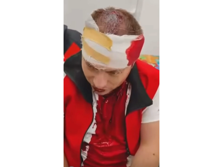 Опит за убийство след заснемане на екологичен проблем